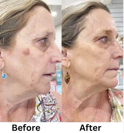 glacial facial before after gail